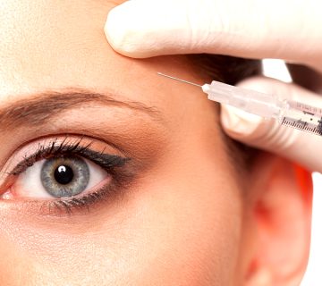 درمان خط اخم، خط خنده و رشته های گردن با بوتاکس