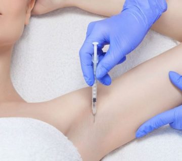 بوتاکس زیر بغل