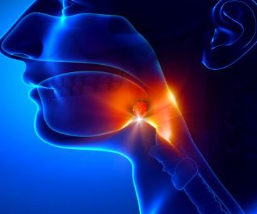 مراقبت بعد از جراحی لوزه سوم چگونه است؟ 4 مراقبت بعد از جراحی لوزه