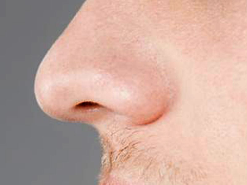 The mans nose01- دلیل بینی بزرگ مردان مشخص شد