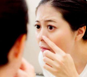 لیفت بینی با نخ یا عمل جراحی بینی؟ 5 لیفت بینی با نخ یا عمل جراحی بینی